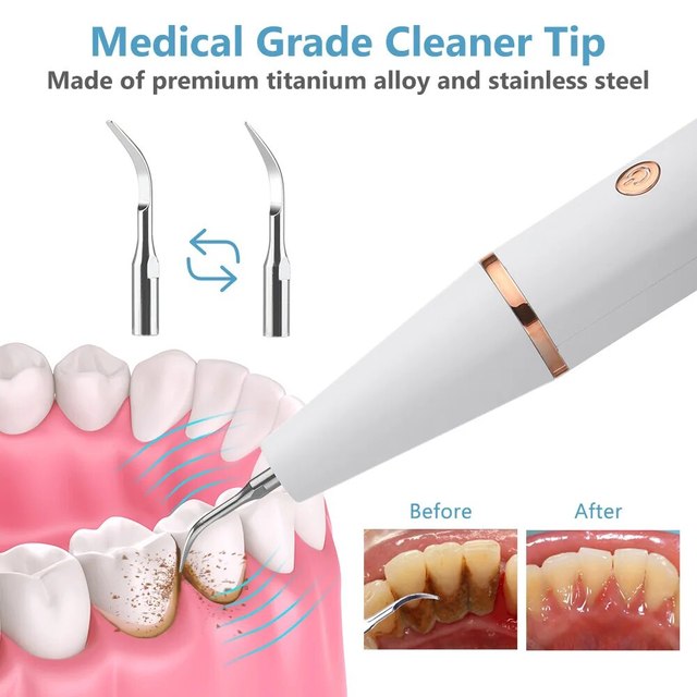 Ultrasonic Scaling Wand: Efficient and safe tooth cleaning at home with LED light and USB quick-charge function