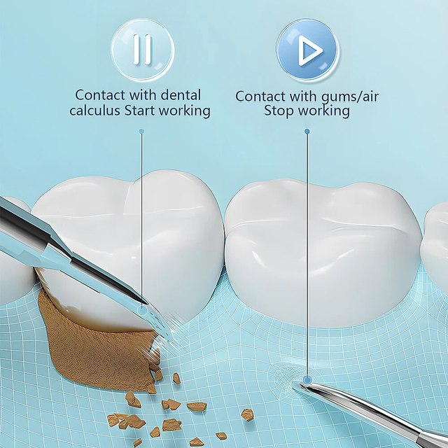 Ultrasonic Scaling Wand: Efficient and safe tooth cleaning at home with LED light and USB quick-charge function