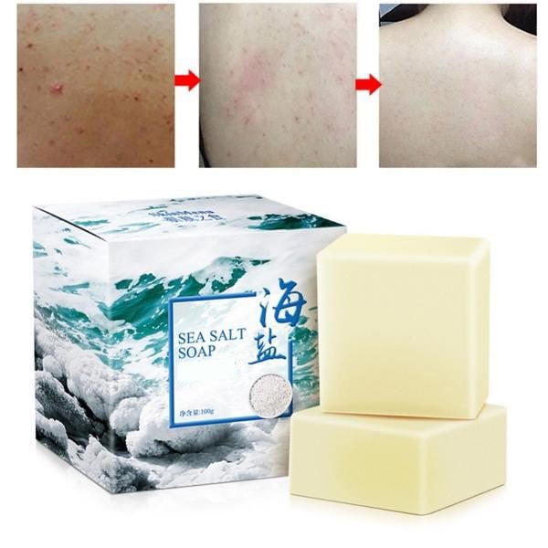 Sea Salt Soap - Acne Treatment