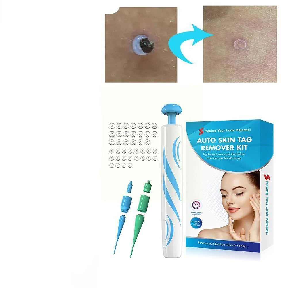 Auto Skin Tag Remover Painless