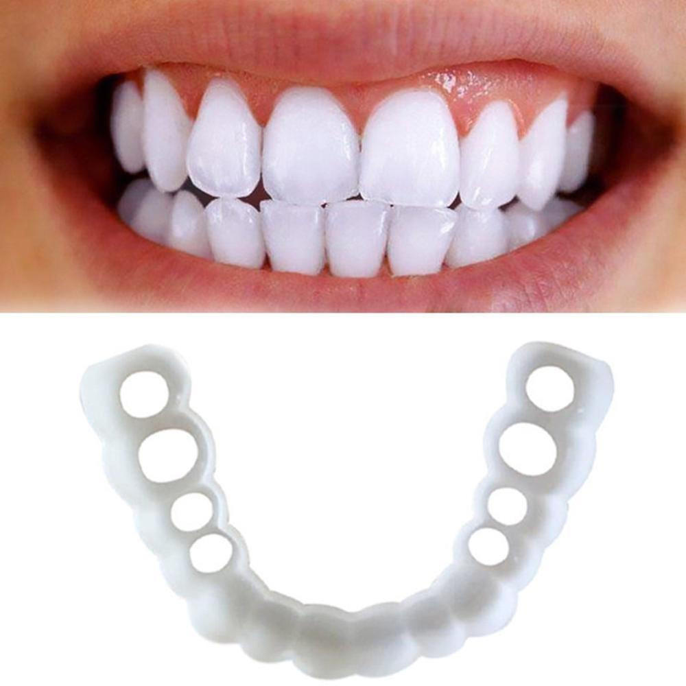 Facial Tooth Cover Retainer