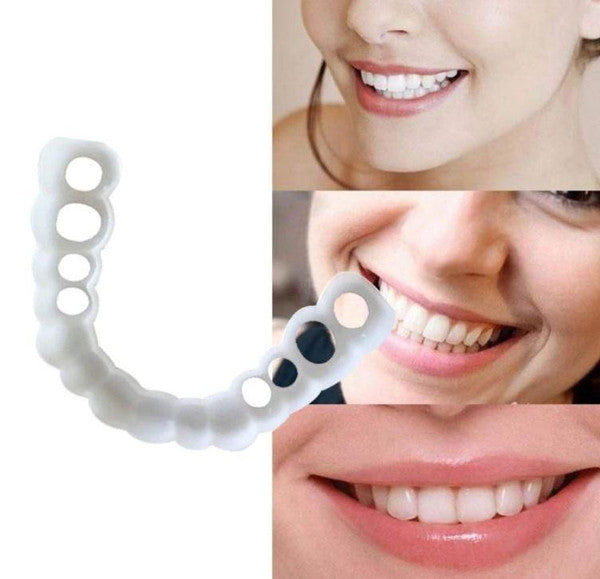 Facial Tooth Cover Retainer