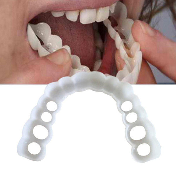 Facial Tooth Cover Retainer