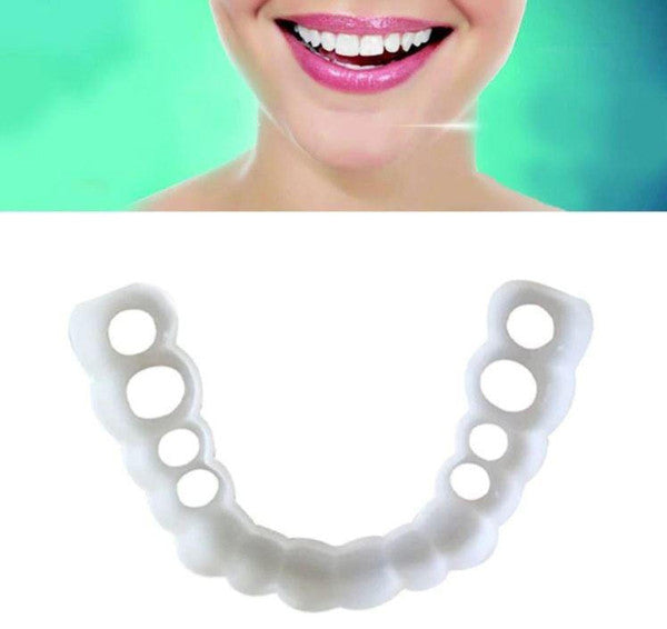 Facial Tooth Cover Retainer